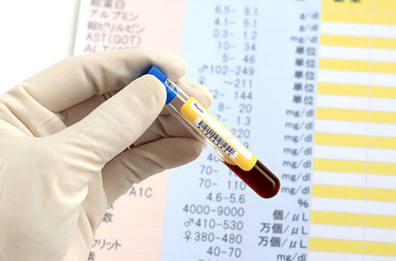 血液検査